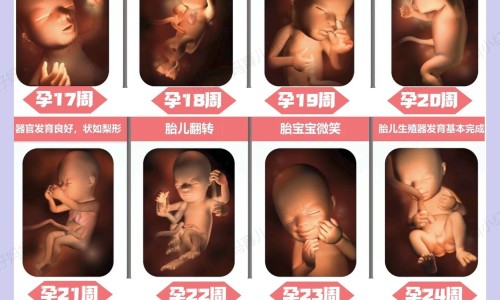 权威产后风湿严重到全身怎么治疗平台,分享专业产后风湿挂什么科知识_产后风湿用什么中药膏网